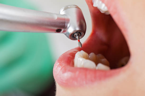 Best Pediatric Emergency Dentist in Centerville, PA